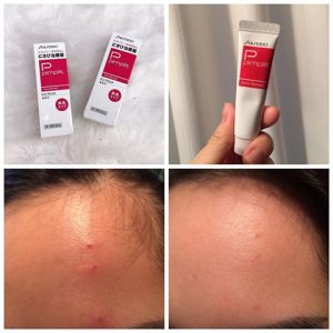 Kem trị mụn Shiseido Pimplit giả và thật phân biệt như thế nào?