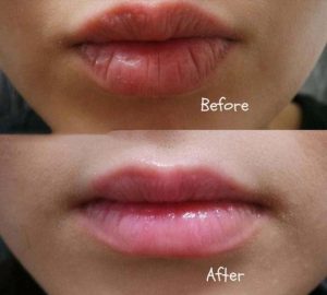 Kem làm hồng môi tự nhiên BQCELL XXVIRGIN LIP 2