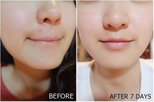 Sữa rửa mặt Angel's Liquid Tone Up Glutathione Deep Pore 2