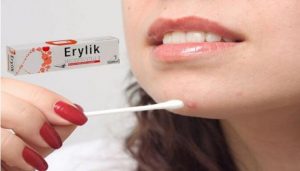 Thuốc trị mụn Erylik có tốt không?