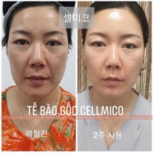 Serum tế bào gốc Cellmico review