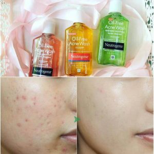 Sữa Rữa Mặt Kiềm Dầu Neutrogena Oil Free Acne Wash 150ml 4