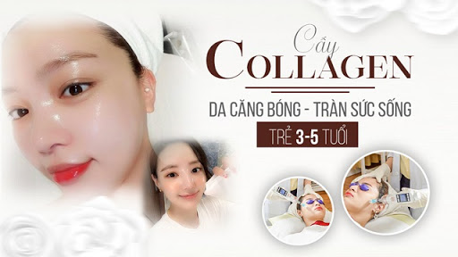 Cấy Collagen Tươi Là Gì? Cần Lưu Ý Những Gì? 1