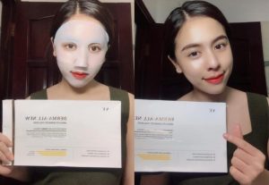 REVIEW mặt nạ Derma All NEW