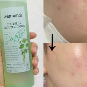 REVIEW Toner rau má Mamonde