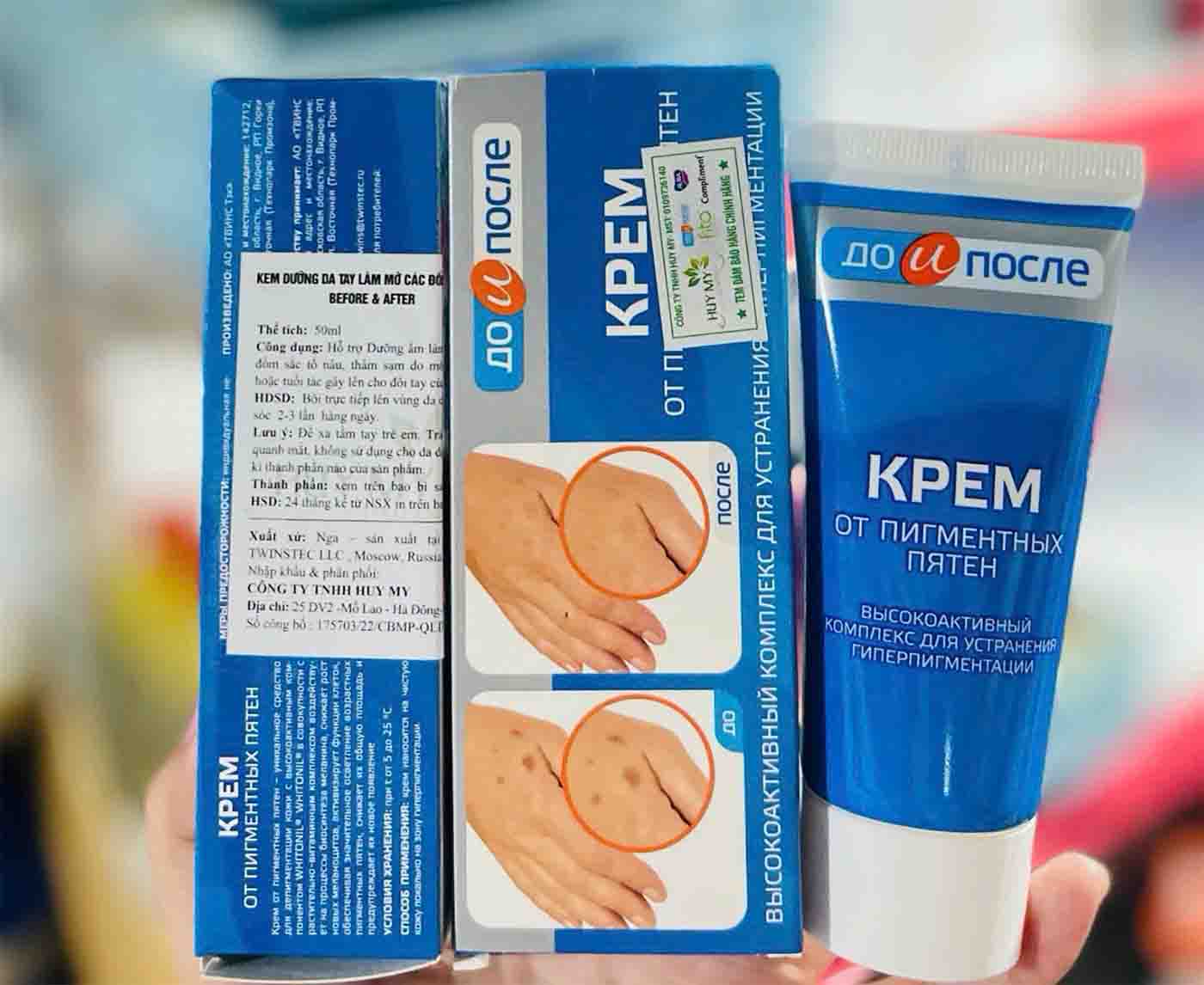kem hỗ trợ giảm đồi mồi Kpem của Nga