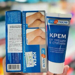 Kem hỗ trợ giảm nứt gót chân Kpem của Nga
