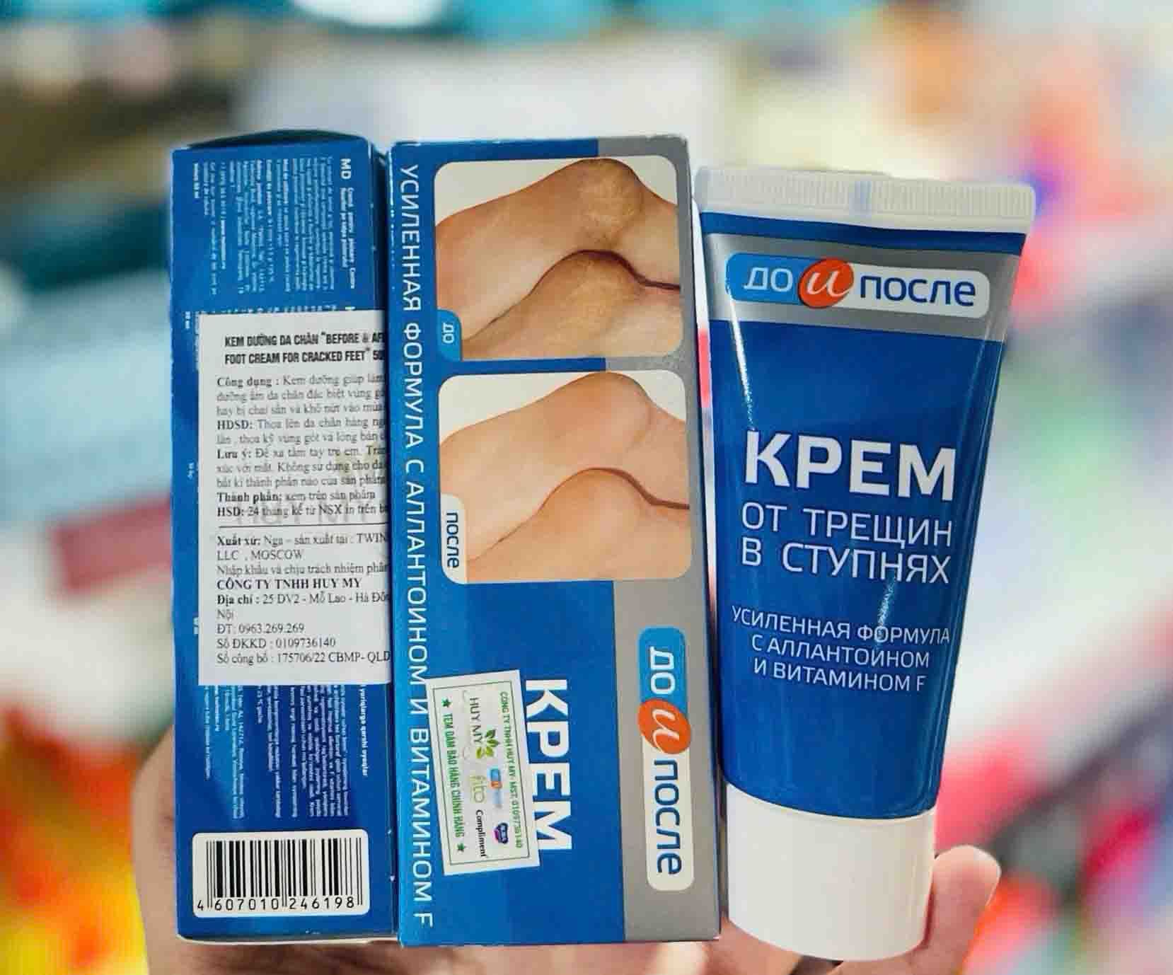 Kem hỗ trợ giảm nứt gót chân Kpem của Nga