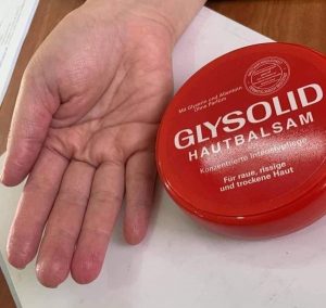 Kem trị nứt gót chân Glysolid có tốt không?