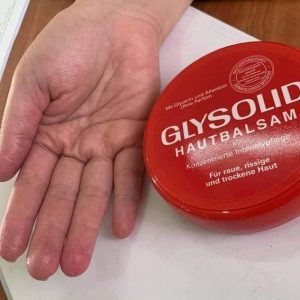 Kem trị nứt gót chân Glysolid có tốt không?