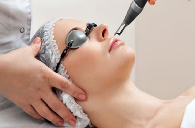 trị thâm môi bằng laser