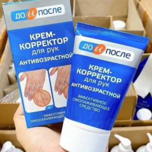 kpem koppektop