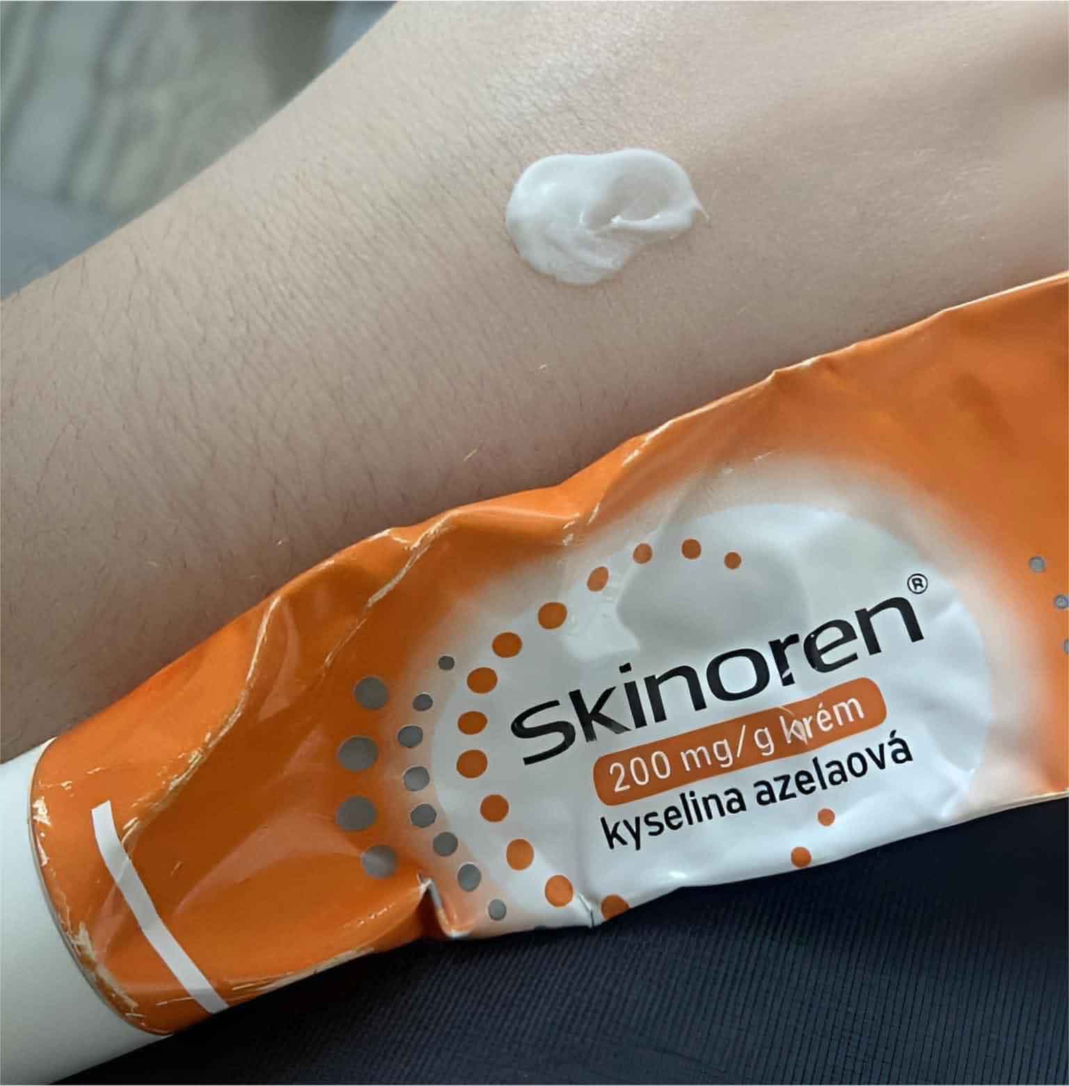 Kem hỗ trợ giảm mụn Skinoren 20 Cream